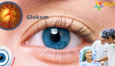 Glokom Hastalığı (Göz Tansiyonu) Nedir? Nedenleri, Belirtileri, Teşhisi ve Tedavisi