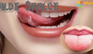Dilde Sivilce Neden Çıkar? Ne İyi Gelir? Nasıl Geçer?