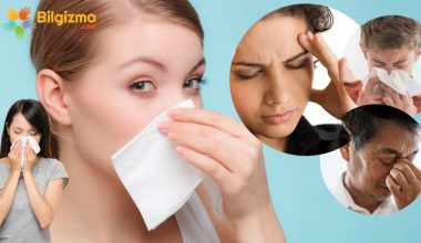 Sinüzit Nedir? Belirtileri, Teşhisi ve Tedavisi